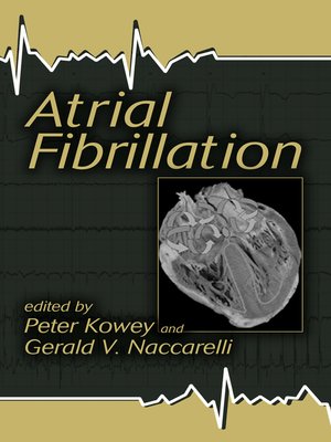 cover image of Atrial Fibrillation